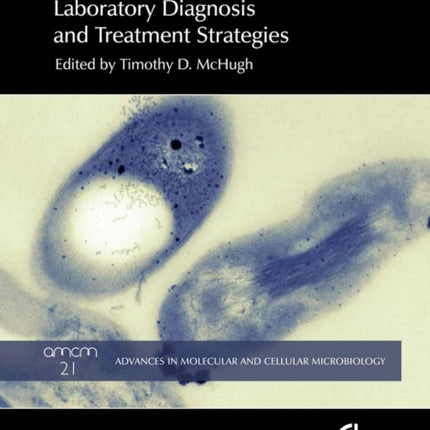 Tuberculosis: Laboratory Diagnosis and Treatment