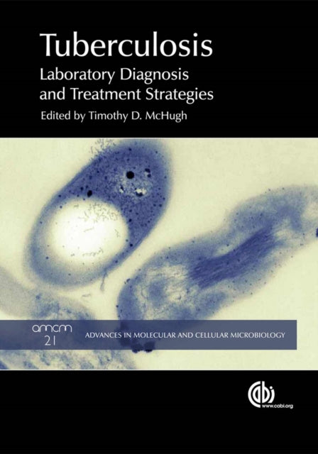 Tuberculosis: Laboratory Diagnosis and Treatment