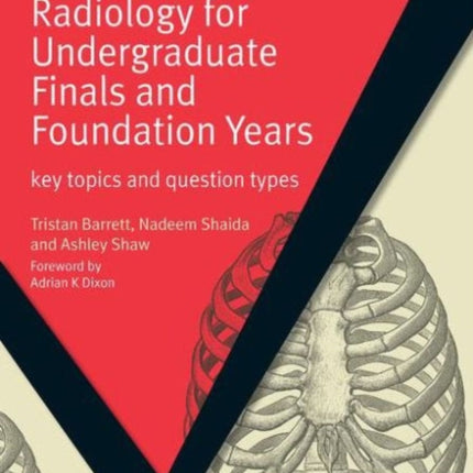 Radiology for Undergraduate Finals and Foundation Years: Key Topics and Question Types