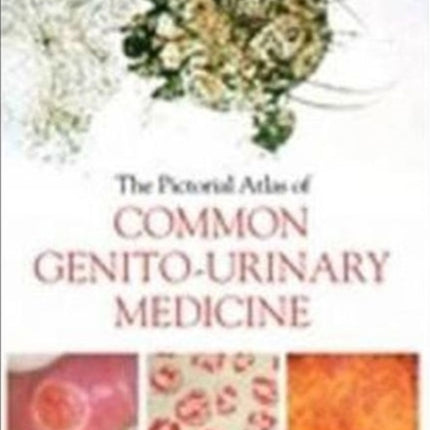 The Pictorial Atlas of Common Genito-Urinary Medicine