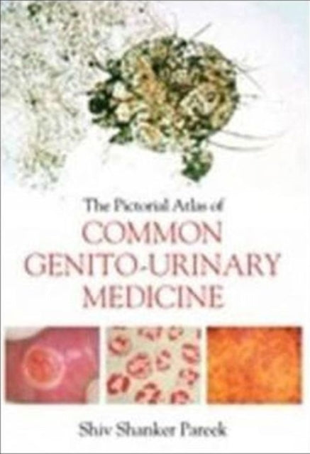 The Pictorial Atlas of Common Genito-Urinary Medicine