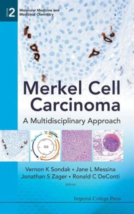 Merkel Cell Carcinoma: A Multidisciplinary