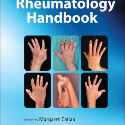 Rheumatology Handbook, The