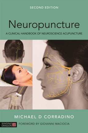 Neuropuncture: A Clinical Handbook of Neuroscience Acupuncture