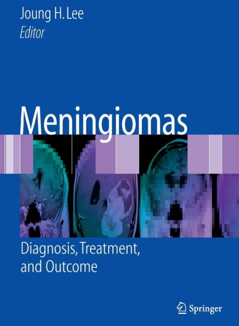 Meningiomas: Diagnosis, Treatment, and Outcome