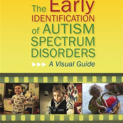 The Early Identification of Autism Spectrum Disorders: A Visual Guide