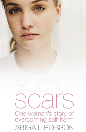 Secret Scars: One Woman's Story of Overcoming