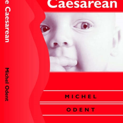 The Caesarean