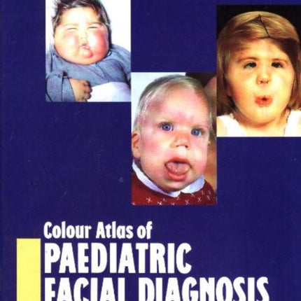 Colour Atlas of Paediatric Facial Diagnosis