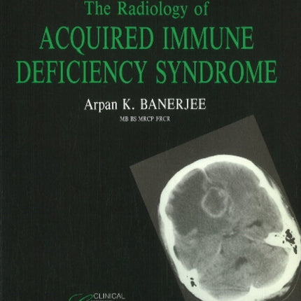 Radiology of Acquired Immune Deficiency Syndrome