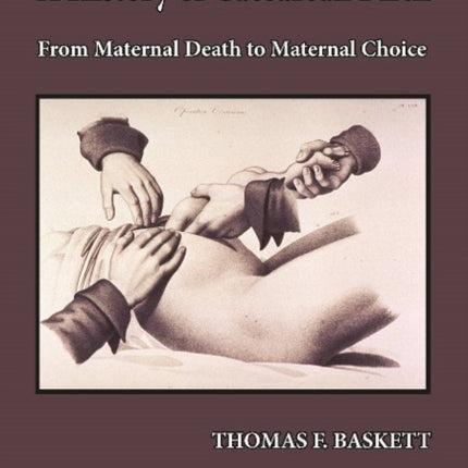 History of Caesarean Birth: From Maternal Death to Maternal Choice