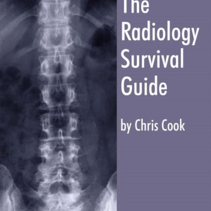The Radiology Survival Guide: for Students and