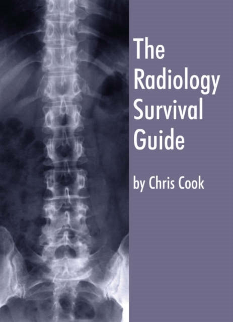 The Radiology Survival Guide: for Students and