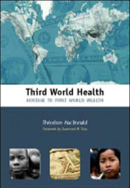 Third World Health: Hostage to First World Wealth