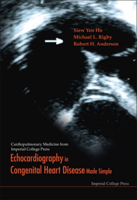 Echocardiography In Congenital Heart Disease Made Simple