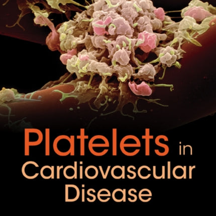 Platelets In Cardiovascular Disease