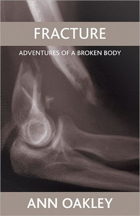 Fracture: Adventures of a broken body