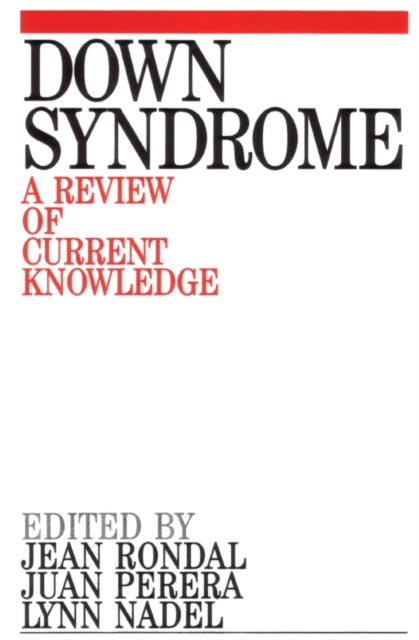 Down Syndrome: A Review of Current Knowledge