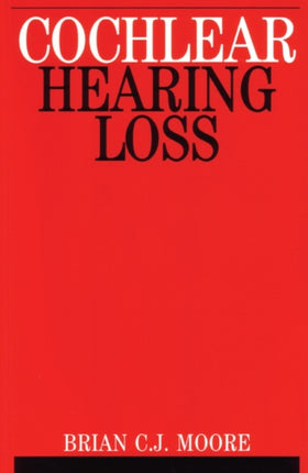 Cochlear Hearing Loss