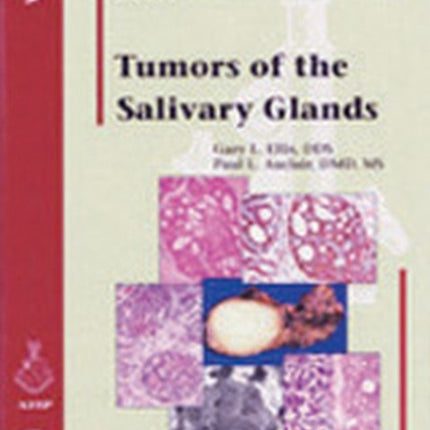 Tumors of the Salivary Glands 9 AFIP Atlas of Tumor Pathology Series 4