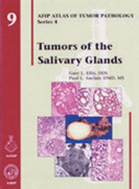 Tumors of the Salivary Glands 9 AFIP Atlas of Tumor Pathology Series 4