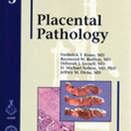 Placental Pathology