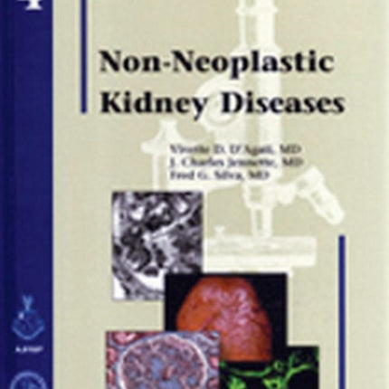 Non-Neoplastic Kidney Diseases