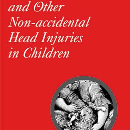 Shaking and Other Non-Accidental Head Injuries in Children