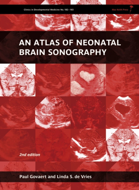 An Atlas of Neonatal Brain Sonography