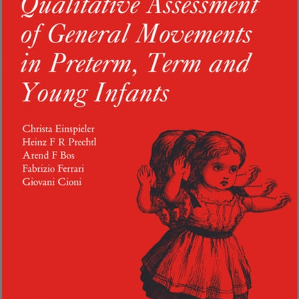Prechtl's Method on the Qualitative Assessment of
