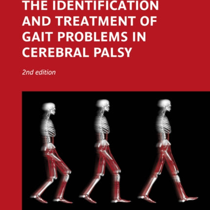 The Identification and Treatment of Gait Problems in Cerebral Palsy