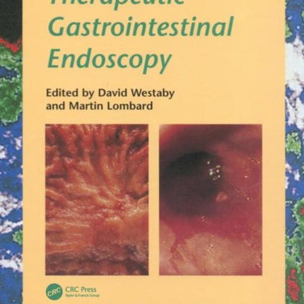 Therapeutic Gastrointestinal Endoscopy