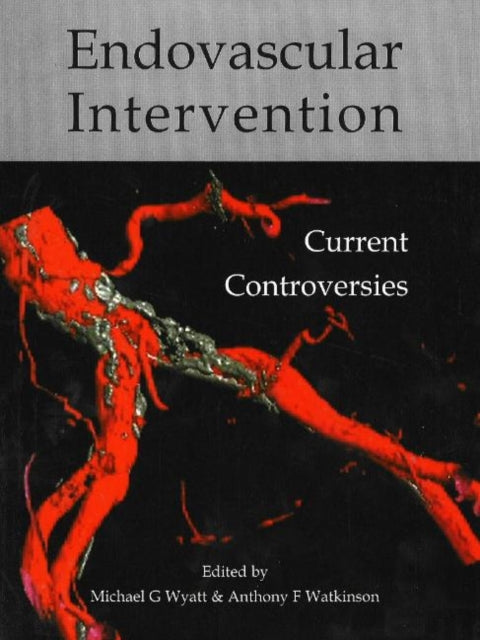 Endovascular intervention: Current controversies