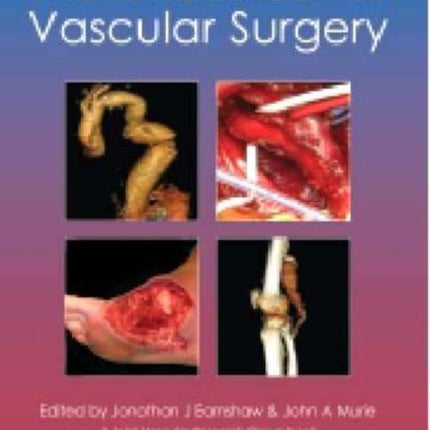 Evidence for Vascular Surgery: 2nd Edition