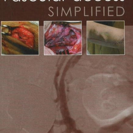 Vascular Access Simplified; second edition