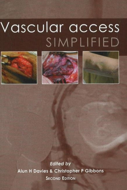 Vascular Access Simplified; second edition