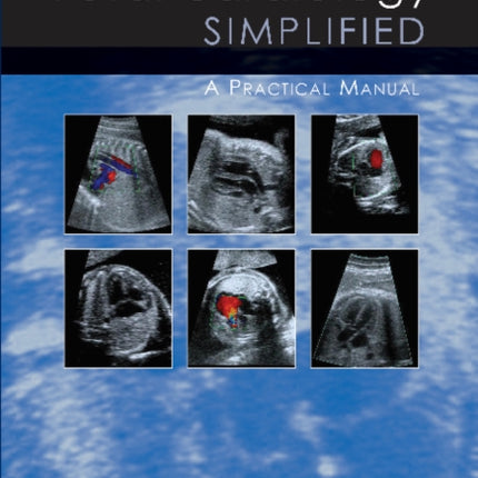 Fetal Cardiology Simplified: A Practical Manual