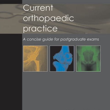 Current Orthopaedic Practice: A Concise Guide for Postgraduate Exams