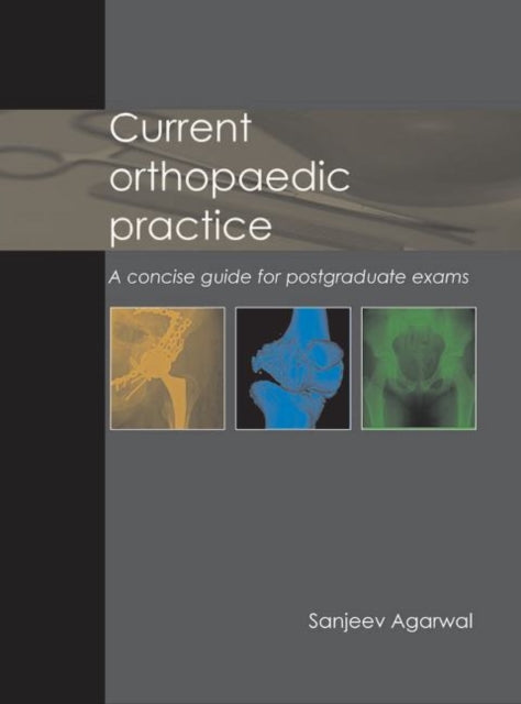 Current Orthopaedic Practice: A Concise Guide for Postgraduate Exams