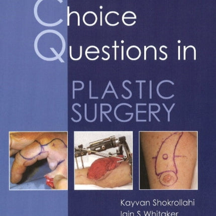 MCQs in Plastic Surgery