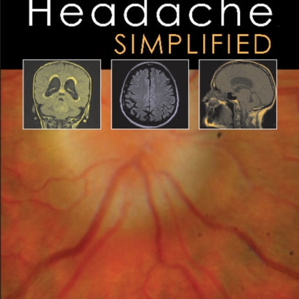 Headache Simplified