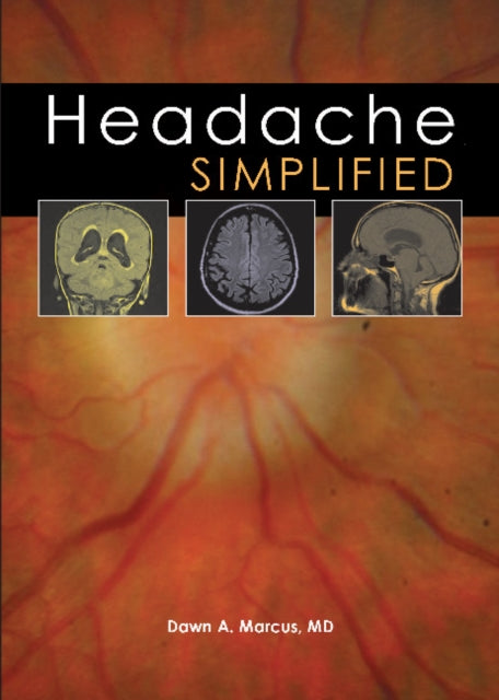 Headache Simplified