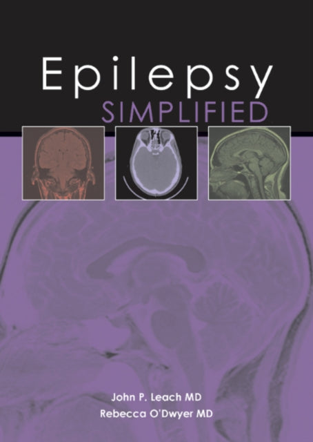 Epilepsy Simplified