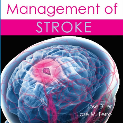 Evidence-based Management of Stroke