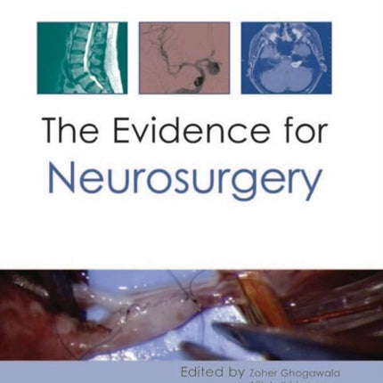 Evidence for Neurosurgery