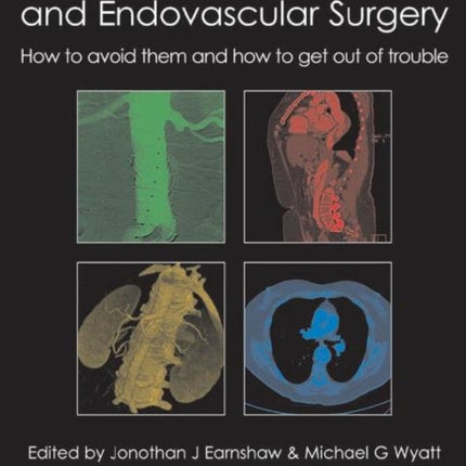 Complications in Vascular & Endovascular Surgery: How to Avoid Them & How to Get Out of Trouble