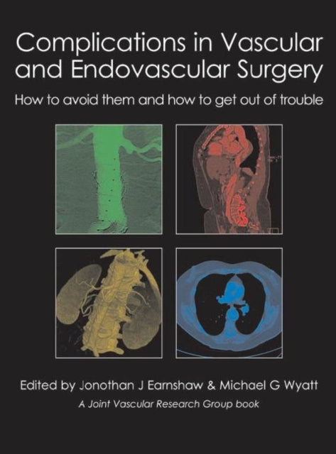 Complications in Vascular & Endovascular Surgery: How to Avoid Them & How to Get Out of Trouble