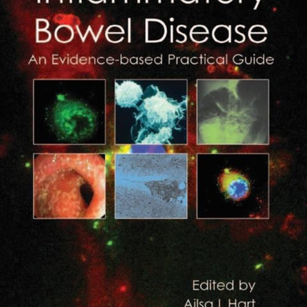 Inflammatory Bowel Disease: an Evidence-based Practical Guide