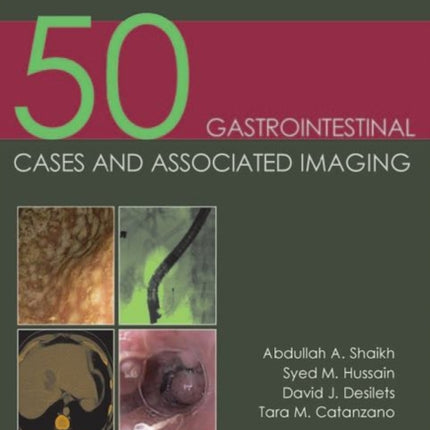 50 Gastrointestinal Cases and Associated Imaging