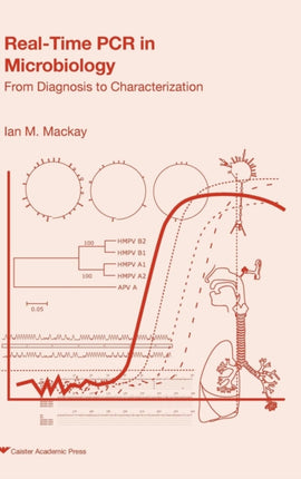 Real-time PCR in Microbiology: From Diagnosis to